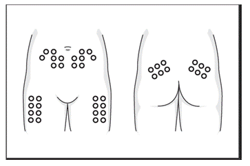 LEO INNOHEP 2014.08.27 TAB5